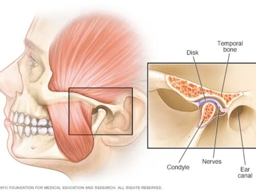 UNDERSTANDING TEMPOROMANDIBULAR JOINT DYSFUNCTION